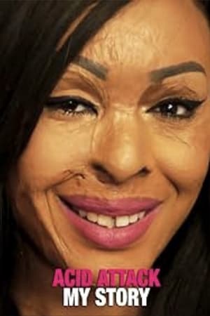 Acid Attack: My Story watch Acid Attack: My Story