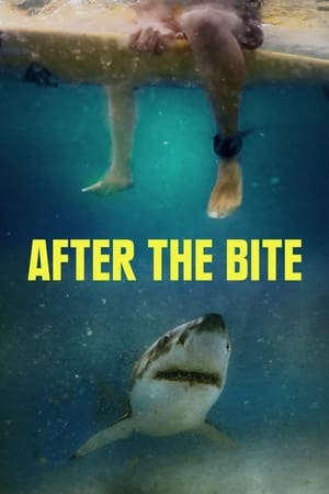 After the Bite watch After the Bite