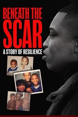 watch Beneath the Scar: A Story of Resilience