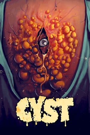 Cyst watch Cyst