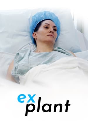 Explant watch Explant