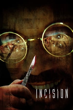 Incision watch Incision