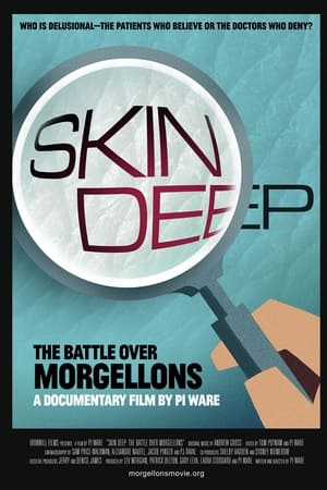 watch Skin Deep: The Battle Over Morgellons