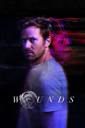 Wounds watch Wounds